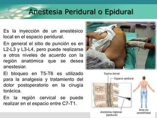 Anestesia Peridural o Epidural
Es la inyección de un anestésico
local en el espacio peridural.
En general el sitio de punción es en
L2-L3 y L3-L4, pero puede realizarse
a otros niveles de acuerdo con la
región anatómica que se desea
anestesiar.
El bloqueo en T5-T6 es utilizado
para la analgesia y tratamiento del
dolor postoperatorio en la cirugía
torácica.
En la región cervical se puede
realizar en el espacio entre C7-T1.
 