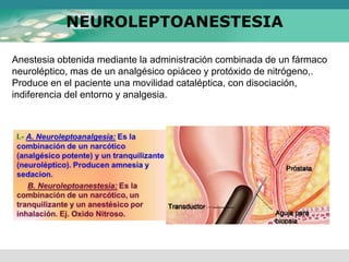 NEUROLEPTOANESTESIA
Anestesia obtenida mediante la administración combinada de un fármaco
neuroléptico, mas de un analgésico opiáceo y protóxido de nitrógeno,.
Produce en el paciente una movilidad cataléptica, con disociación,
indiferencia del entorno y analgesia.
 