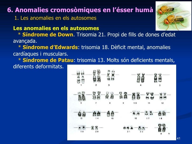 Resultat d'imatges de trisomia 21 o SÃ­ndrome de Down, trisomia 18 o SÃ­ndrome Edwards, trisomia 13 o SÃ­ndrome de Patau,, i les anomalies dels cromosomes sexuals com la SÃ­ndrome de urner i SÃ­ndrome de Klinefelter entre unes altres. E