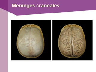 Meninges craneales
 