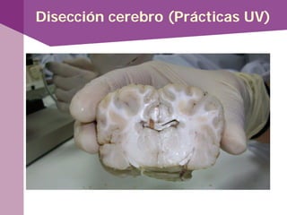 Disección cerebro (Prácticas UV)
 