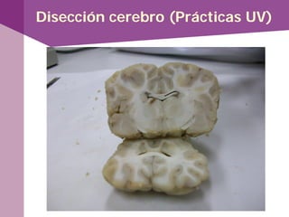 Disección cerebro (Prácticas UV)
 