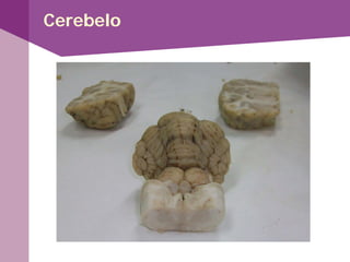 Cerebelo
 