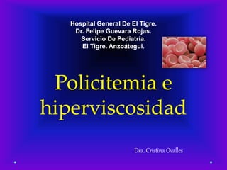 Policitemia e
hiperviscosidad
Dra. Cristina Ovalles
Hospital General De El Tigre.
Dr. Felipe Guevara Rojas.
Servicio De Pediatría.
El Tigre. Anzoátegui.
 