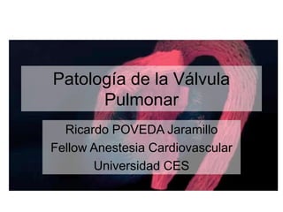 Patología de la Válvula
Pulmonar
Ricardo POVEDA Jaramillo
Fellow Anestesia Cardiovascular
Universidad CES
 