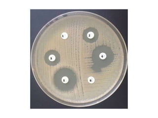 Tema11.1 eso (microorganismos)