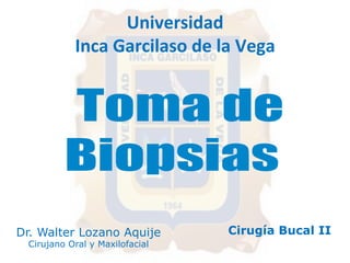 Universidad 
Inca 
Garcilaso 
de 
la 
Vega 
Dr. Walter Lozano Aquije 
Cirujano Oral y Maxilofacial 
Cirugía Bucal II 
 