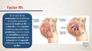 Factor Rh.
En el caso de los
embarazos los problemas
se pueden presentar
cuando la madre es Rh – y
el feto Rh +. En el primer
embarazo no suele haber
problemas, pero la madre
se sensibiliza y produce
anticuerpos anti-Rh, que
actuarán en el segundo
embarazo si el nuevo feto
es Rh+.
 