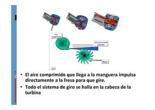 turbina	
  
•  El	
  aire	
  comprimido	
  que	
  llega	
  a	
  la	
  manguera	
  impulsa	
  
directamente	
  a	
  la	
  fresa	
  para	
  que	
  gire.	
  
•  Todo	
  el	
  sistema	
  de	
  giro	
  se	
  halla	
  en	
  la	
  cabeza	
  de	
  la	
  
turbina	
  
Figura 2.14.- Esquema que representa la generación de
movimiento rotatorio a partir de un chorro de aire
comprimido.
Aire proyectado
a presión
Aire proyectado
a presión
JMVJMV
RotorRotor
Aire
comprimido
Aire
comprimido
47
 