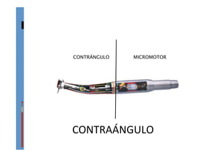 CONTRAÁNGULO	
  
CONTRÁNGULO MICROMOTOR
 
