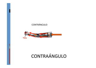 CONTRAÁNGULO	
  
CONTRÁNGULO 
 