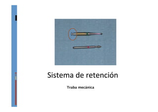 Sistema	
  de	
  retención	
  	
  
Traba mecánica
 