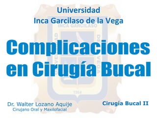 Universidad 
Inca 
Garcilaso 
de 
la 
Vega 
Dr. Walter Lozano Aquije 
Cirujano Oral y Maxilofacial 
Cirugía Bucal II 
 