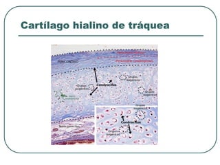 Cartílago hialino de tráquea
 