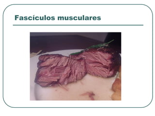 Fascículos musculares
 