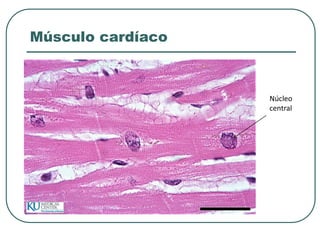 Músculo cardíaco
Núcleo
central
 