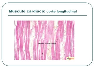 Músculo cardíaco: corte longitudinal
Discos intercalares
 