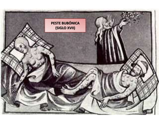 PESTE BUBÓNICA
(SIGLO XVII)
 