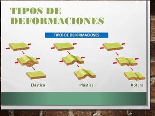 TIPOS DE
DEFORMACIONES
 