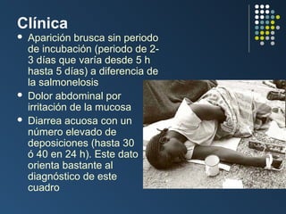 Clínica





Aparición brusca sin periodo
de incubación (periodo de 23 días que varía desde 5 h
hasta 5 días) a diferencia de
la salmonelosis
Dolor abdominal por
irritación de la mucosa
Diarrea acuosa con un
número elevado de
deposiciones (hasta 30
ó 40 en 24 h). Este dato
orienta bastante al
diagnóstico de este
cuadro

 