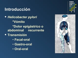 Introducción
 Helicobacter

pylori

*Vómito
*Dolor epigástrico o
abdominal recurrente
 Transmisión
• Fecal-oral
• Gastro-oral
• Oral-oral

 