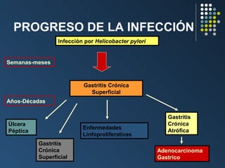 PROGRESO DE LA INFECCIÓN
Infección por Helicobacter pylori

Semanas-meses

Gastritis Crónica
Superficial
Años-Décadas

Úlcera
Péptica

Enfermedades
Linfoproliferativas
Gastritis
Crónica
Superficial

Gastritis
Crónica
Atrófica
Adenocarcinoma
Gastrico

 