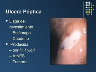Ulcera Péptica
 Llaga

del
revestimiento
– Estómago
– Duodeno
 Producida
– por H. Pylori
– AINES
– Tumores

 