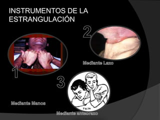 INSTRUMENTOS DE LA
ESTRANGULACIÓN
 
