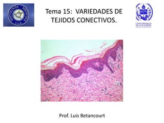 Tema 15: VARIEDADES DE
  TEJIDOS CONECTIVOS.




   Prof. Luis Betancourt
 
