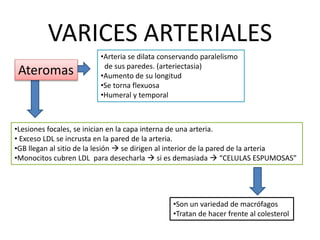 VARICES ARTERIALES
•Arteria se dilata conservando paralelismo
de sus paredes. (arteriectasia)
•Aumento de su longitud
•Se ...