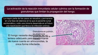 Granuloma en pulmón,
se observa la
autolimitación de la
micosis.
La activación de la reacción inmunitaria celular culmina con la formación de
granulomas que limitan la propagación del hongo.
La mayor parte de los casos se resuelve y permanece
en una fase de latencia en la que el paciente cursa
asintomático y sólo una minoría desarrolla en el futuro
una reactivación que lleva a la infección crónica.
El hongo necesita depositarse en un
terreno adecuado para transformarse
de nueva cuenta en artroconidias, la
única forma infectante.
 