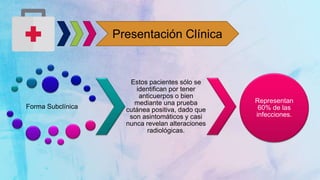 Presentación Clínica
Forma Subclínica
Estos pacientes sólo se
identifican por tener
anticuerpos o bien
mediante una prueba
cutánea positiva, dado que
son asintomáticos y casi
nunca revelan alteraciones
radiológicas.
Representan
60% de las
infecciones.
 