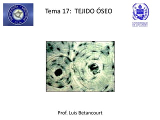 Tema 17: TEJIDO ÓSEO




   Prof. Luis Betancourt
 