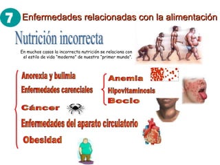 Nutrición incorrecta En muchos casos la incorrecta nutrición se relaciona con el estilo de vida “moderno” de nuestro “primer mundo”. Obesidad Enfermedades del aparato circulatorio Cáncer Enfermedades carenciales Anemia Hipovitaminosis Bocio Anorexia y bulimia Enfermedades relacionadas con la alimentación 7 