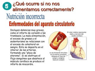 ¿Qué ocurre si no nos alimentamos correctamente? Nutrición incorrecta Enfermedades del aparato circulatorio Incluyen dolencias muy graves, como el infarto de corazón o las trombosis. La mala alimentación, el exceso de grasas y el sedentarismo se relacionan con el exceso de colesterol en sangre. Este se deposita en el interior de las arterias, formando una “placa de ateroma”. Si se obstruye el flujo sanguíneo que abastece al músculo cardíaco se produce el infarto de miocardio.  5 