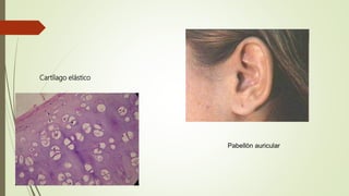 Cartílago elástico
Pabellón auricular
 