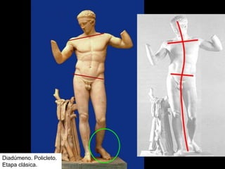 Diadúmeno. Policleto.
Etapa clásica.
 