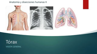 Tórax
VISIÓN GENERAL
Anatomía y disecciones humanas II
 