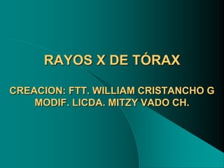 RAYOS X DE TÓRAX
CREACION: FTT. WILLIAM CRISTANCHO G
MODIF. LICDA. MITZY VADO CH.
 