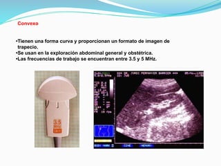Convexo
•Tienen una forma curva y proporcionan un formato de imagen de
trapecio.
•Se usan en la exploración abdominal general y obstétrica.
•Las frecuencias de trabajo se encuentran entre 3.5 y 5 MHz.
 