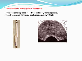 Intracavitarias, transvaginal ó transrectal
•Se usan para exploraciones transrectales y transvaginales.
•Las frecuencias de trabajo suelen ser entre 5 y 7.5 MHz
 