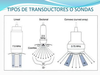 TIPOS DE TRANSDUCTORES O SONDAS
 