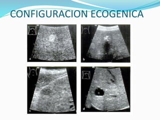 CONFIGURACION ECOGENICA
 