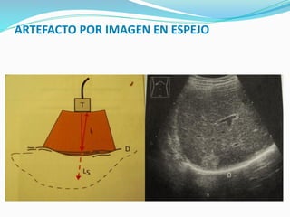 ARTEFACTO POR IMAGEN EN ESPEJO
 