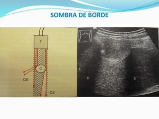 SOMBRA DE BORDE
 