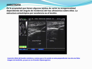 ANISOTROPIA
Es la propiedad que tienen algunos tejidos de variar su ecogenicididad
dependiendo del ángulo de incidencia del haz ultrasónico sobre ellos. La
estructura anisotrópica por excelencia es el tendón.
inserción tibial del tendón rotuliano y vemos que si la sonda no esta perpendicular nos da una falsa
imagen de tendinitis, ya que se ve el tendón hipoecogénico
 