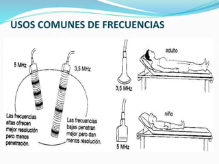 USOS COMUNES DE FRECUENCIAS
 