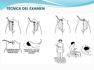 TÉCNICA DEL EXAMEN
 