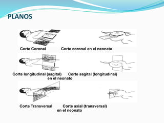 PLANOS
Corte Coronal Corte coronal en el neonato
Corte longitudinal (sagital) Corte sagital (longitudinal)
en el neonato
Corte Transversal Corte axial (transversal)
en el neonato
 