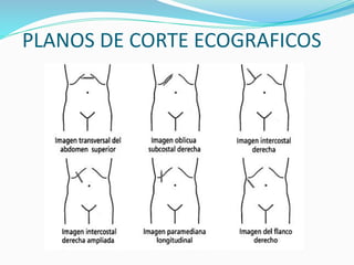 PLANOS DE CORTE ECOGRAFICOS
 